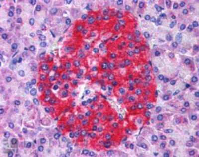 Immunohistochemistry-Paraffin: Annexin A10 Antibody [NB300-894]