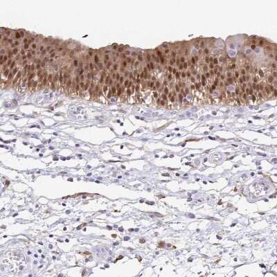 Immunohistochemistry-Paraffin: Annexin A10 Antibody [NBP1-90156]