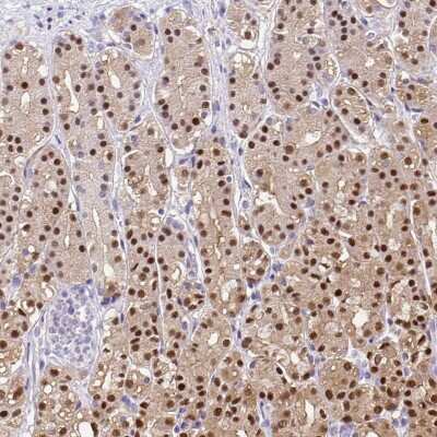 Immunohistochemistry-Paraffin: Annexin A10 Antibody [NBP1-90156]