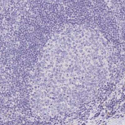 Immunohistochemistry-Paraffin: Annexin A10 Antibody [NBP1-90156]
