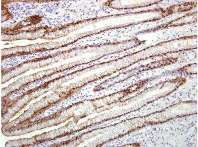 Immunohistochemistry-Paraffin: Annexin A10 Antibody [NBP2-15404]