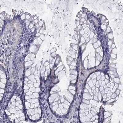 Immunohistochemistry-Paraffin: Annexin A10 Antibody [NBP3-16992]
