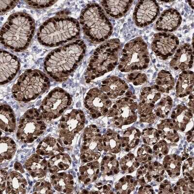 Immunohistochemistry-Paraffin: Annexin A10 Antibody [NBP3-16992]