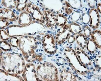 Immunohistochemistry: Annexin A10 Antibody (OTI4D8) - Azide and BSA Free [NBP2-71683]