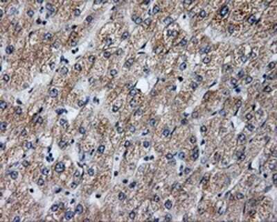 Immunohistochemistry: Annexin A10 Antibody (OTI4D8) - Azide and BSA Free [NBP2-71683]