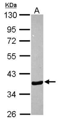 Western Blot: Annexin A10 Antibody [NBP2-15404]