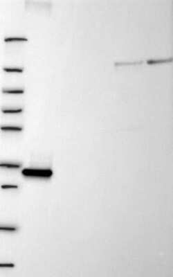 Western Blot: Annexin A10 Antibody [NBP3-16992]