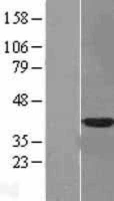 Western Blot: Annexin A10 Overexpression Lysate [NBL1-07558]