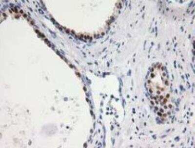 Immunohistochemistry-Paraffin: Annexin A11 Antibody (OTI1C6) [NBP2-02342]