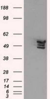 Western Blot: Annexin A11 Antibody (OTI1C6) [NBP2-02342]