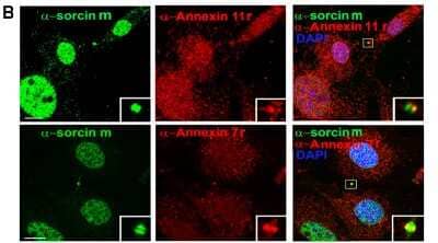 Immunocytochemistry/ Immunofluorescence: Annexin A11 Antibody [NB100-78588]