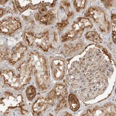 Immunohistochemistry-Paraffin: Annexin A11 Antibody [NBP1-90160]
