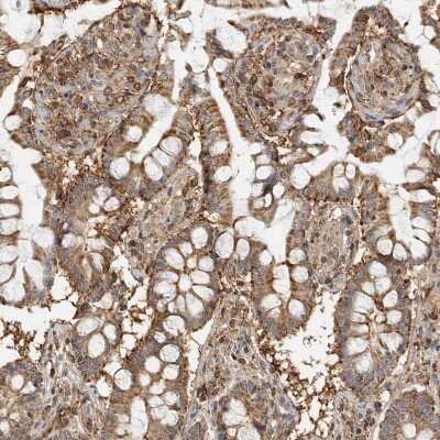 Immunohistochemistry-Paraffin: Annexin A11 Antibody [NBP1-90160]