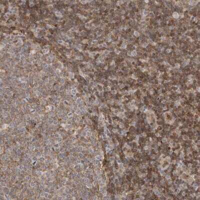 Immunohistochemistry-Paraffin: Annexin A11 Antibody [NBP1-90160]