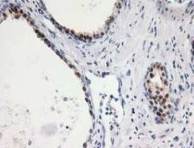 Immunohistochemistry: Annexin A11 Antibody (OTI1C6) - Azide and BSA Free [NBP2-70182]