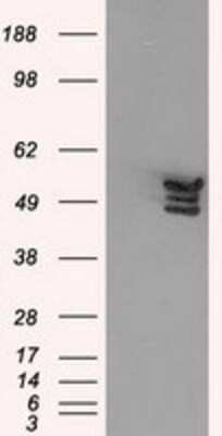 Western Blot: Annexin A11 Antibody (OTI1C6)Azide and BSA Free [NBP2-70182]