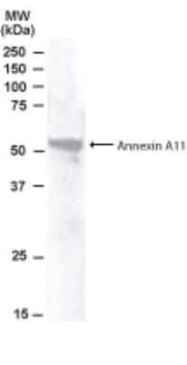 Western Blot: Annexin A11 Antibody [NB300-875]