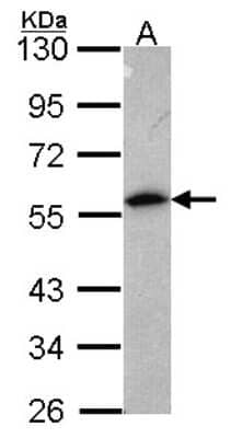 Western Blot: Annexin A11 Antibody [NBP2-15405]