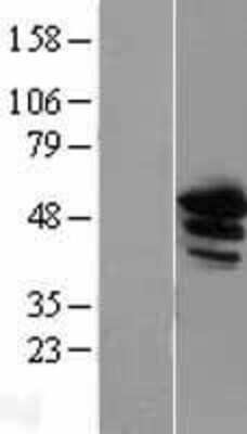 Western Blot: Annexin A11 Overexpression Lysate [NBL1-07559]