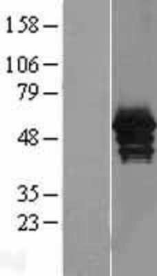 Western Blot: Annexin A11 Overexpression Lysate [NBL1-07560]