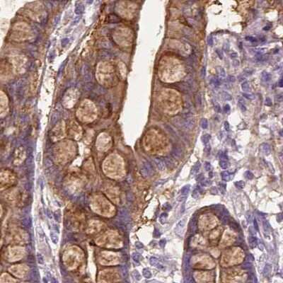 Immunohistochemistry-Paraffin: Annexin A13 Antibody [NBP1-90157]