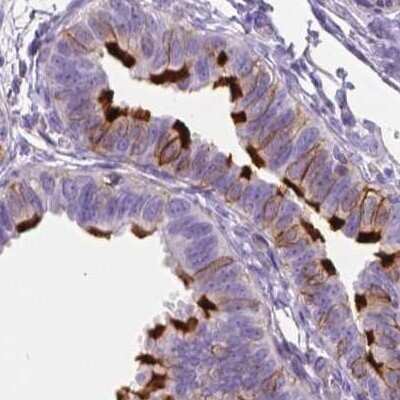 Immunohistochemistry-Paraffin: Annexin A13 Antibody [NBP1-90157]