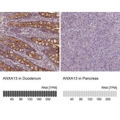 Immunohistochemistry-Paraffin: Annexin A13 Antibody [NBP1-90158]