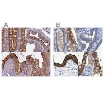 Immunohistochemistry-Paraffin: Annexin A13 Antibody [NBP1-90158]