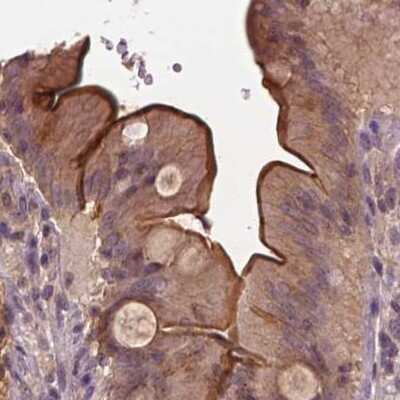 Immunohistochemistry-Paraffin: Annexin A13 Antibody [NBP1-90158]