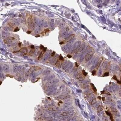 Immunohistochemistry-Paraffin: Annexin A13 Antibody [NBP1-90158]