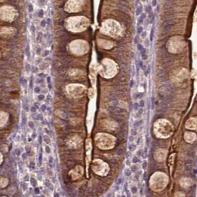 Immunohistochemistry-Paraffin: Annexin A13 Antibody [NBP1-90158]