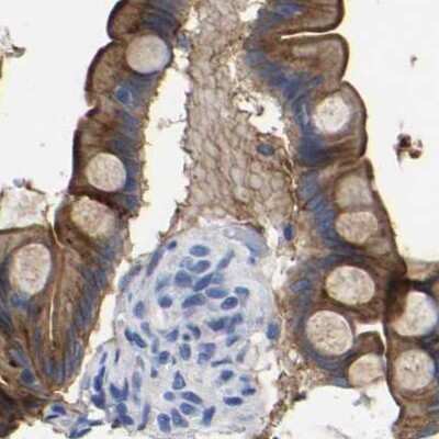 Immunohistochemistry-Paraffin: Annexin A13 Antibody [NBP1-90159]