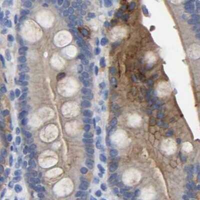 Immunohistochemistry-Paraffin: Annexin A13 Antibody [NBP1-90159]