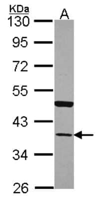 Western Blot: Annexin A13 Antibody [NBP1-30985]