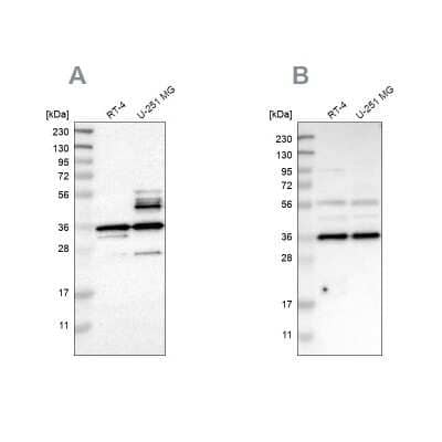 Western Blot: Annexin A13 Antibody [NBP1-90157]