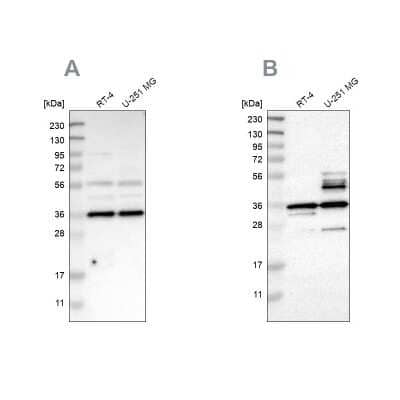 Western Blot: Annexin A13 Antibody [NBP1-90158]