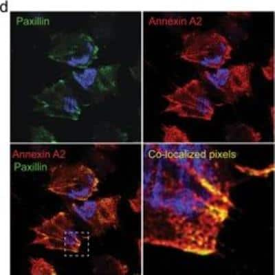 Immunocytochemistry/ Immunofluorescence: Annexin A2 Antibody (1G7) [H00000302-M02]