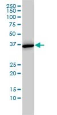 Western Blot: Annexin A2 Antibody (1G7) [H00000302-M02]