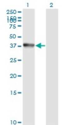 Western Blot: Annexin A2 Antibody (1G7) [H00000302-M02]