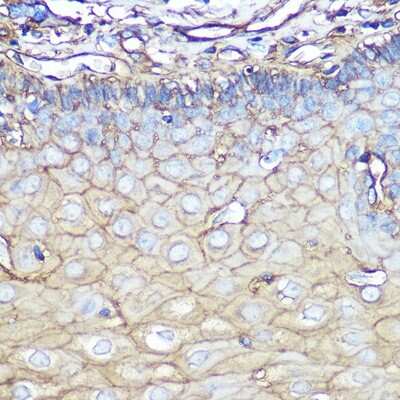 Immunohistochemistry-Paraffin: Annexin A2 Antibody (1W2B5) [NBP3-15360]