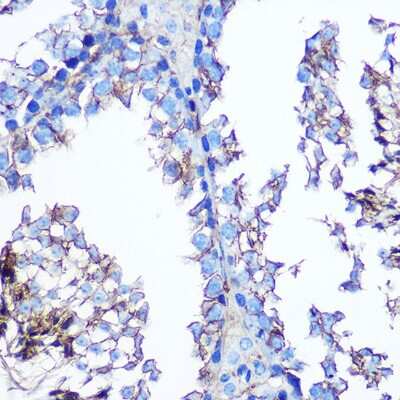 Immunohistochemistry-Paraffin: Annexin A2 Antibody (1W2B5) [NBP3-15360]