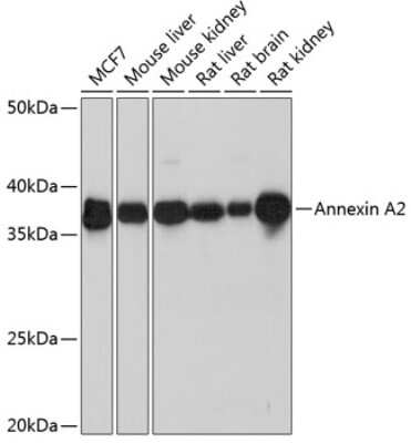 Western Blot: Annexin A2 Antibody (1W2B5) [NBP3-15360]