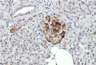 Immunohistochemistry-Paraffin: Annexin A2 Antibody [NBP1-31310]