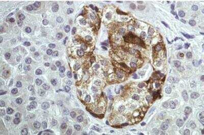 Immunohistochemistry-Paraffin: Annexin A2 Antibody [NBP1-31310]