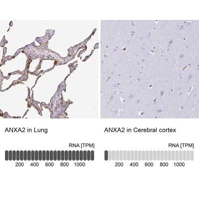 Immunohistochemistry-Paraffin: Annexin A2 Antibody [NBP2-62614]