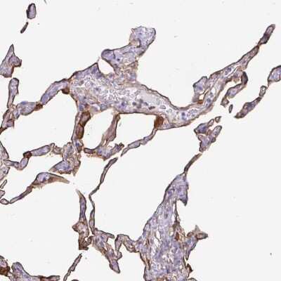 Immunohistochemistry-Paraffin: Annexin A2 Antibody [NBP2-62614]