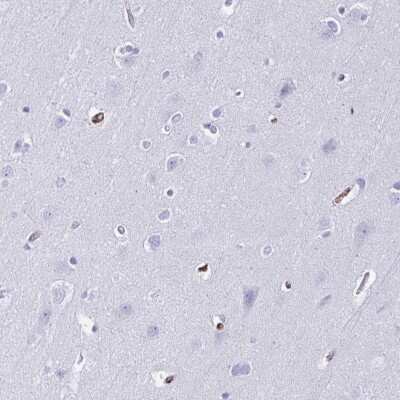 Immunohistochemistry-Paraffin: Annexin A2 Antibody [NBP2-62614]