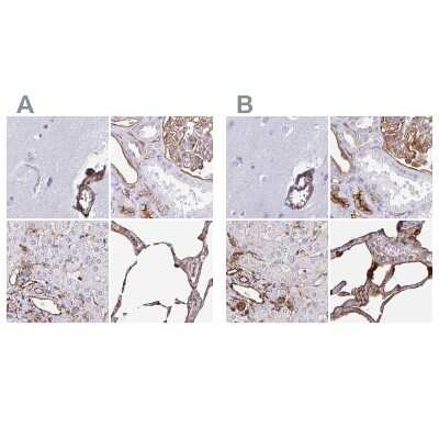 Immunohistochemistry-Paraffin: Annexin A2 Antibody [NBP2-62614]