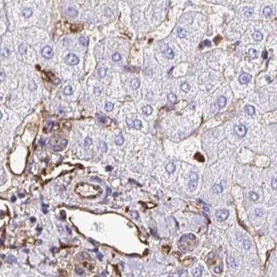 Immunohistochemistry-Paraffin: Annexin A2 Antibody [NBP2-62614]