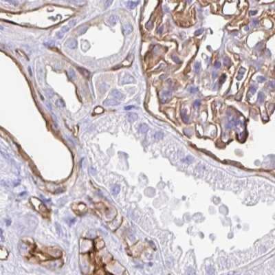 Immunohistochemistry-Paraffin: Annexin A2 Antibody [NBP2-62614]